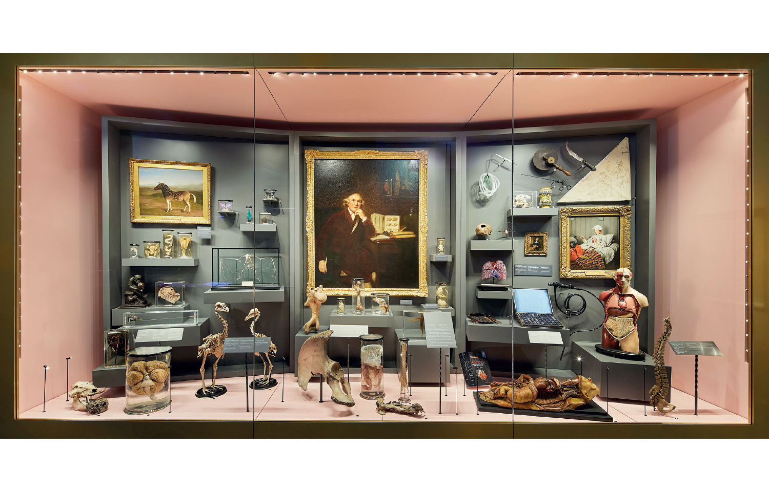 Are surgical museums such as the Hunterian doomed The Spectator